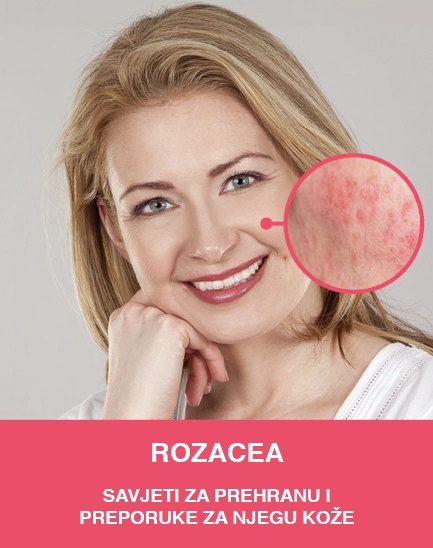 Rozacea